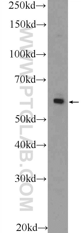 Western Blot (WB) analysis of A549 cells using ZNF419 Polyclonal antibody (25724-1-AP)
