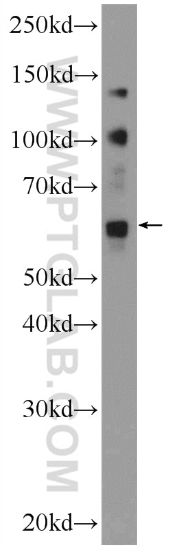 Western Blot (WB) analysis of Jurkat cells using ZNF419 Polyclonal antibody (25724-1-AP)