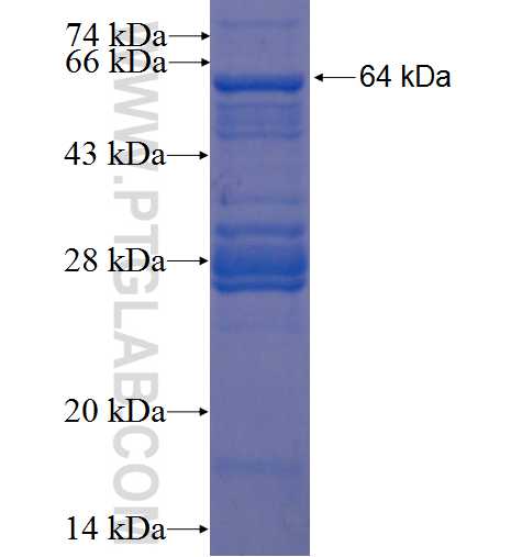 ZNF419 fusion protein Ag22802 SDS-PAGE