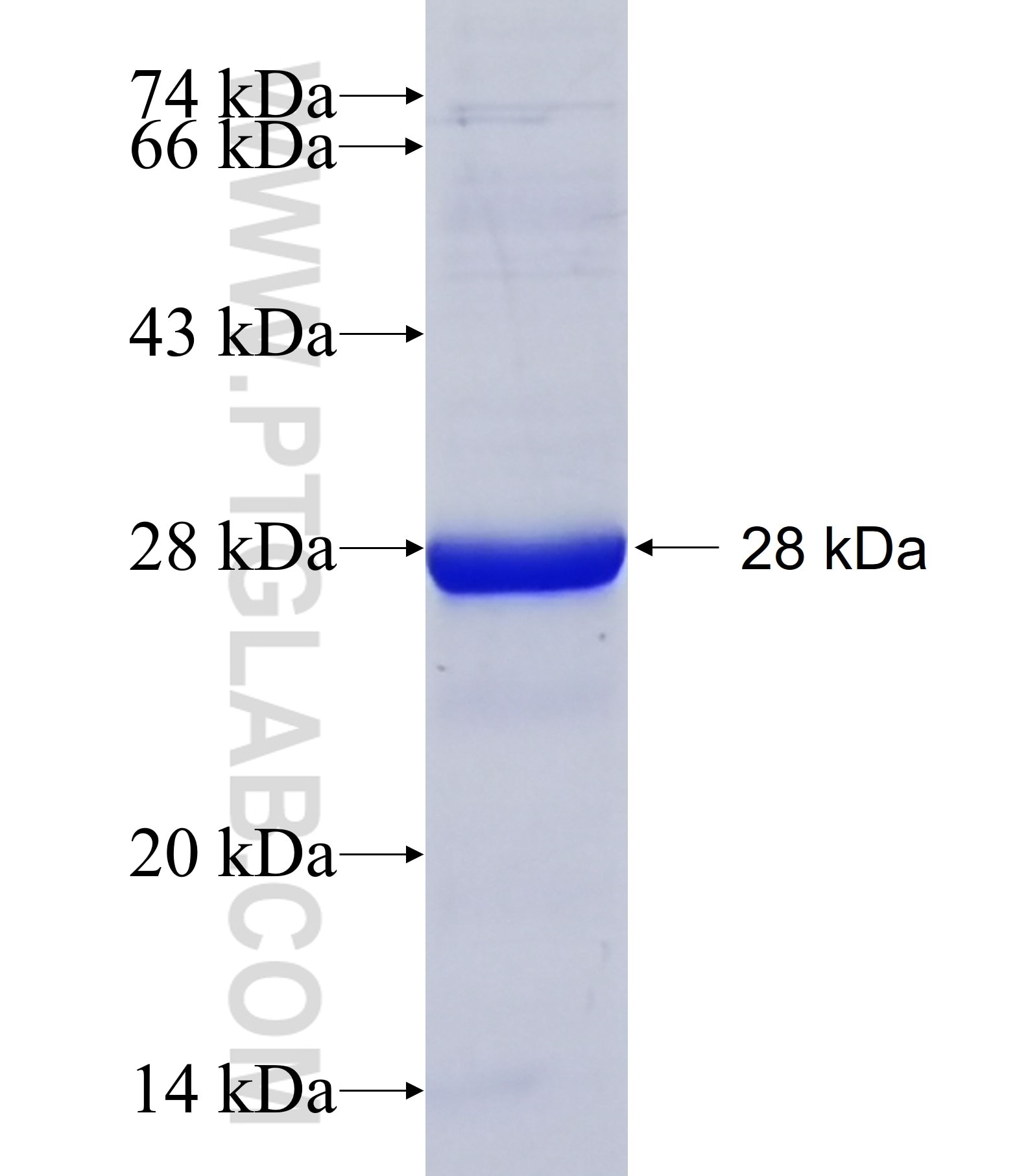 ZNF425 fusion protein Ag40851 SDS-PAGE ZNF425 fusion protein Ag40851 SDS-PAGE