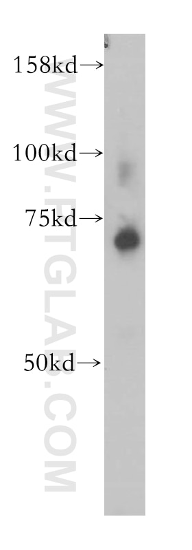 Western Blot (WB) analysis of mouse ovary tissue using ZNF443 Polyclonal antibody (13667-1-AP)