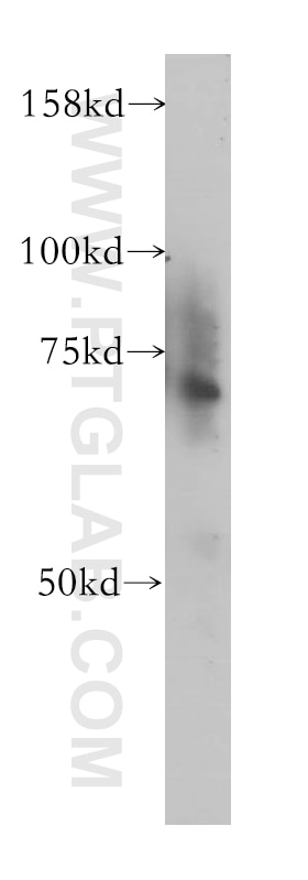 Western Blot (WB) analysis of mouse lung tissue using ZNF443 Polyclonal antibody (13667-1-AP)