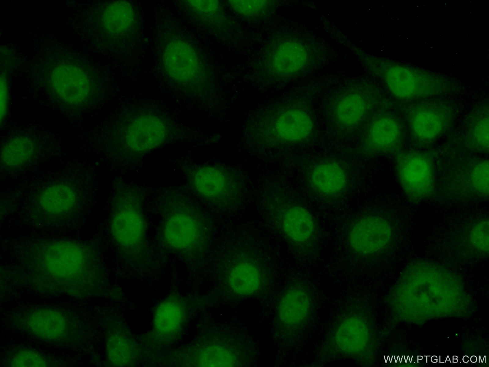 Immunofluorescence (IF) / fluorescent staining of SH-SY5Y cells using ZNF446 Polyclonal antibody (16218-1-AP)