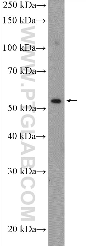 Western Blot (WB) analysis of SH-SY5Y cells using ZNF446 Polyclonal antibody (16218-1-AP)