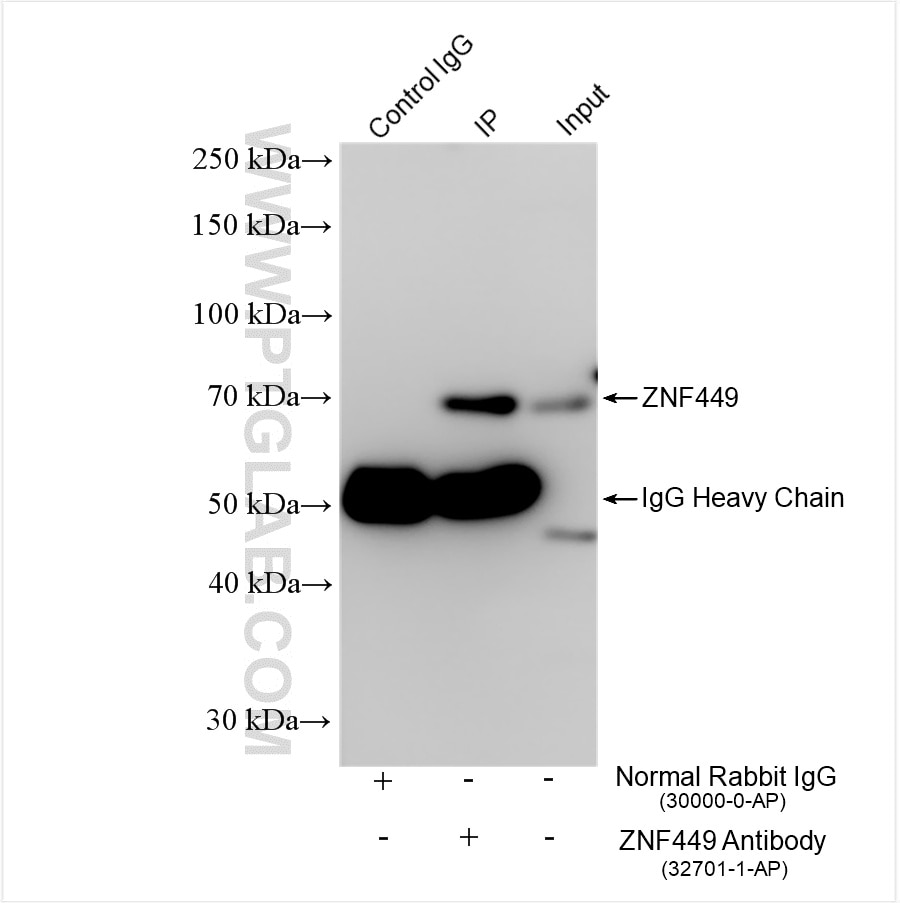 Immunoprecipitation (IP) experiment of HEK-293 cells using ZNF449 Polyclonal antibody (32701-1-AP)