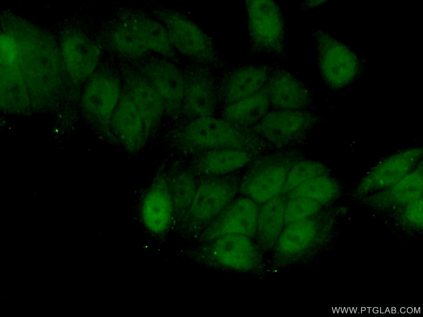 Immunofluorescence (IF) / fluorescent staining of HeLa cells using ZNF451 Polyclonal antibody (25228-1-AP)