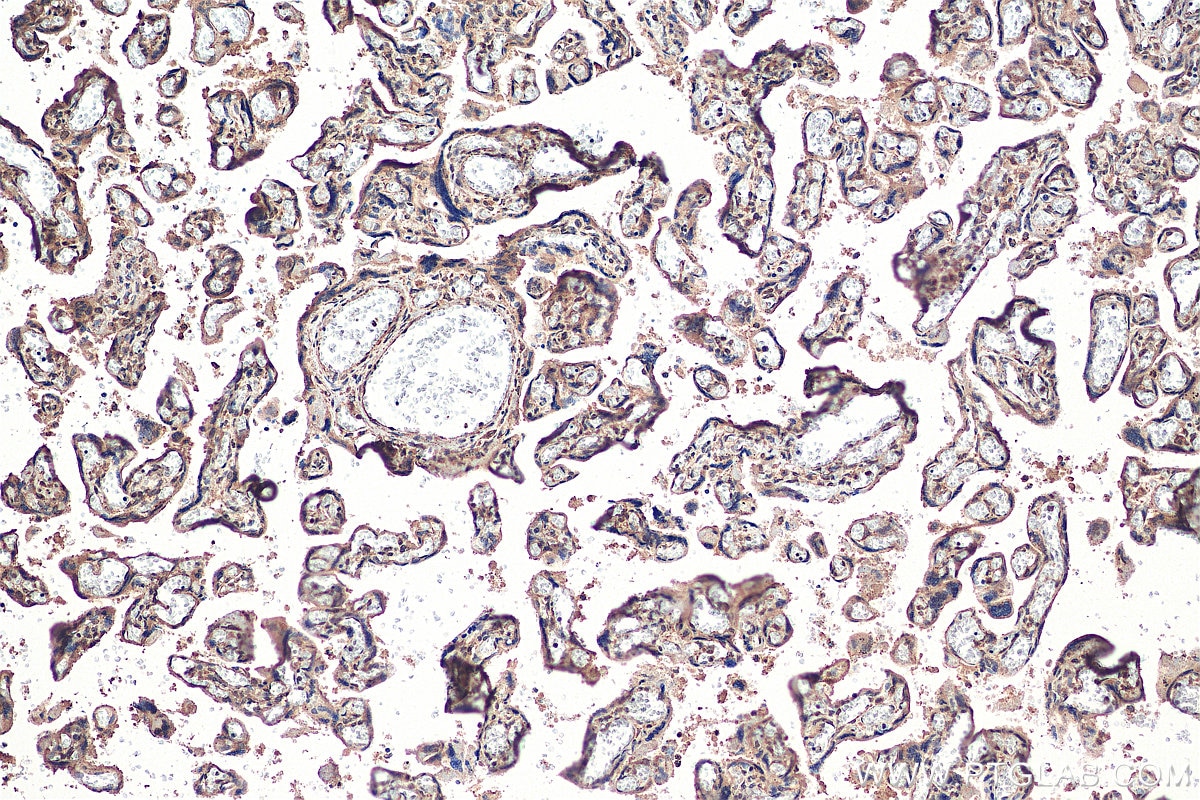 Immunohistochemistry (IHC) staining of human placenta tissue using ZNF451 Polyclonal antibody (25228-1-AP)