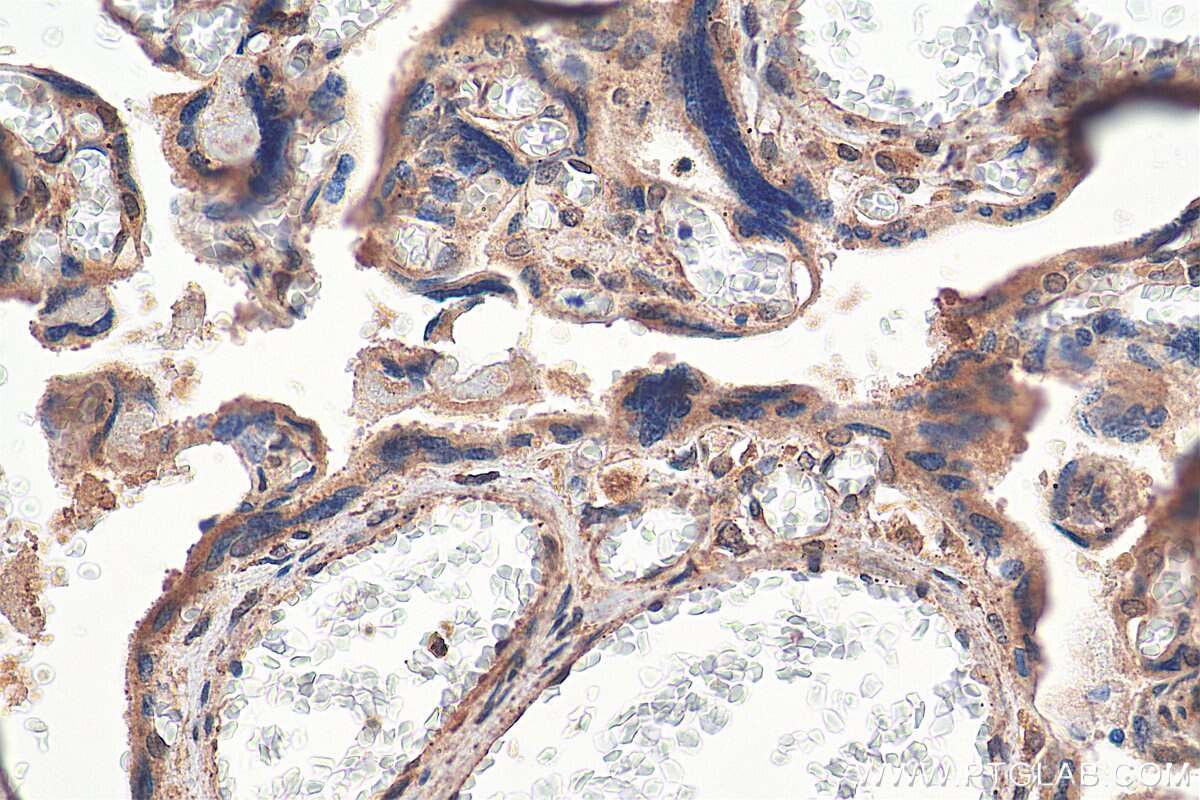 Immunohistochemistry (IHC) staining of human placenta tissue using ZNF451 Polyclonal antibody (25228-1-AP)