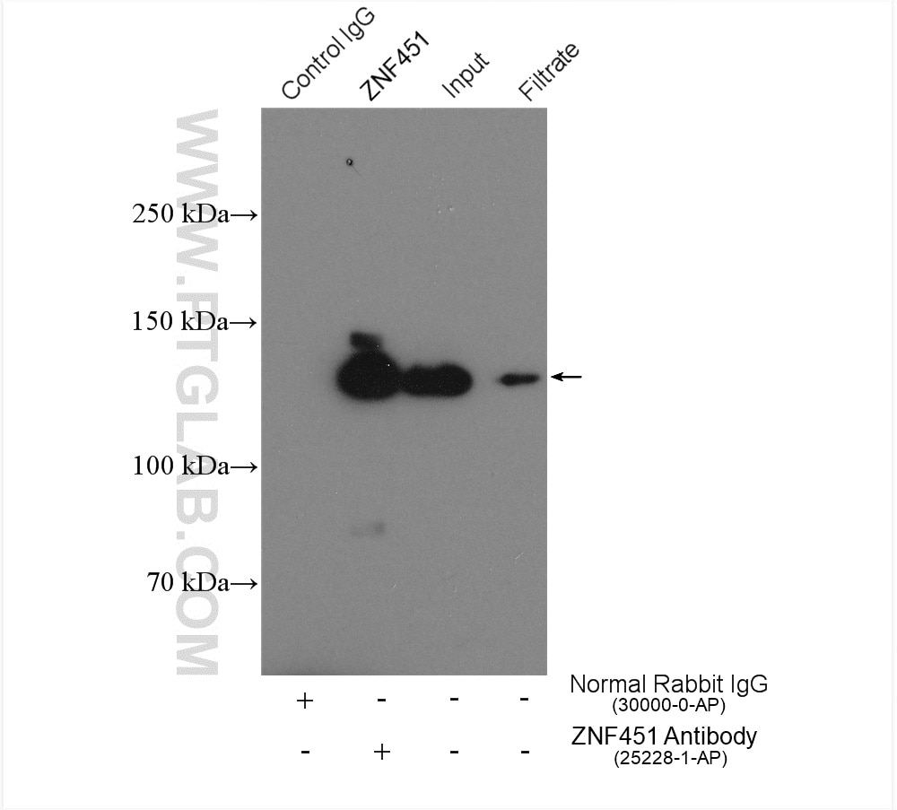 Immunoprecipitation (IP) experiment of HeLa cells using ZNF451 Polyclonal antibody (25228-1-AP)