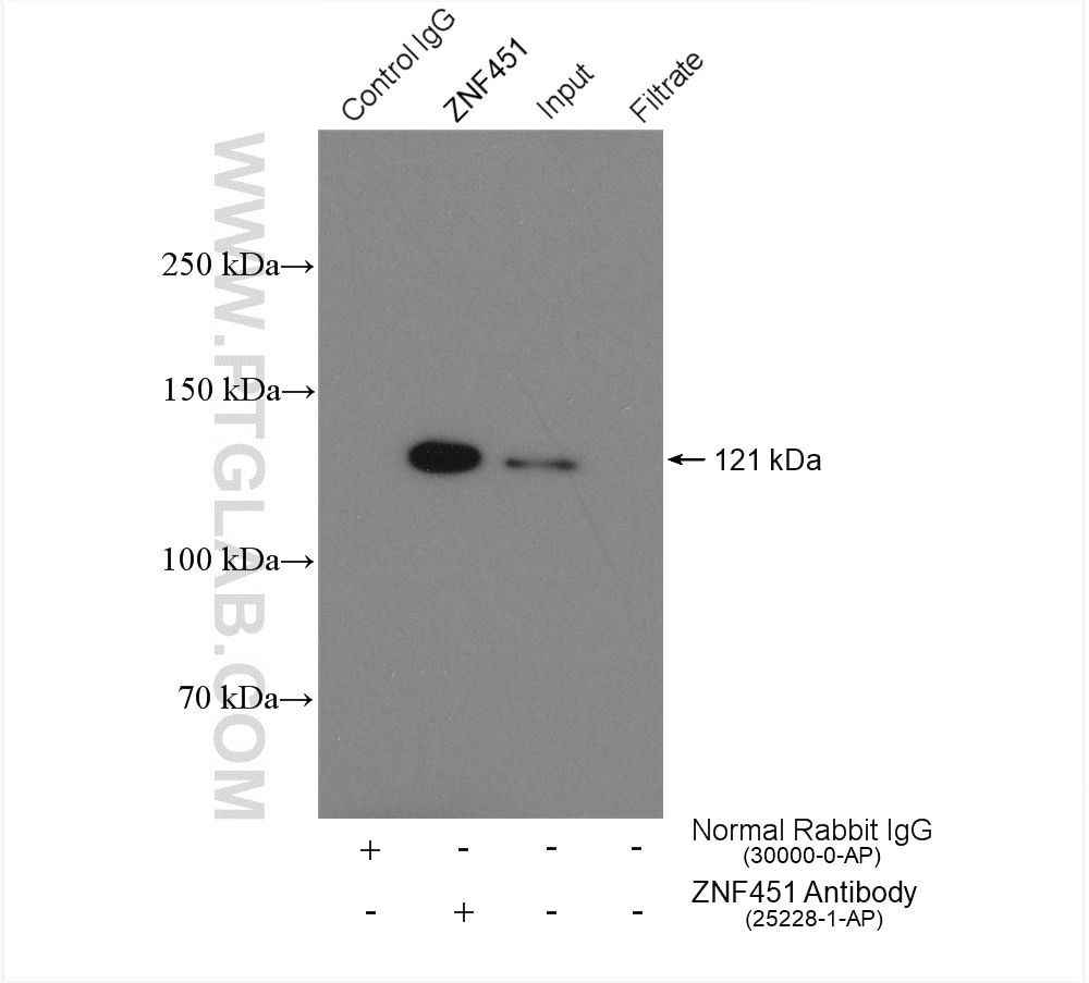 Immunoprecipitation (IP) experiment of HeLa cells using ZNF451 Polyclonal antibody (25228-1-AP)