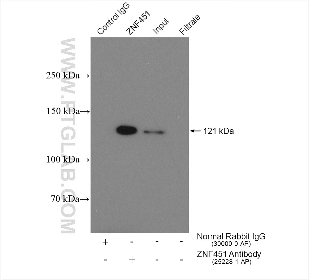 Immunoprecipitation (IP) experiment of HeLa cells using ZNF451 Polyclonal antibody (25228-1-AP)