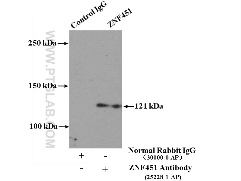 Immunoprecipitation (IP) experiment of HeLa cells using ZNF451 Polyclonal antibody (25228-1-AP)