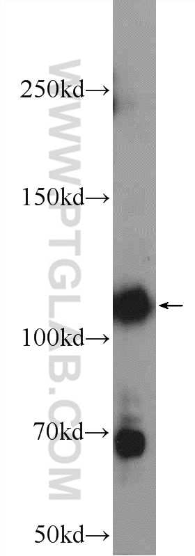Western Blot (WB) analysis of HeLa cells using ZNF451 Polyclonal antibody (25228-1-AP)