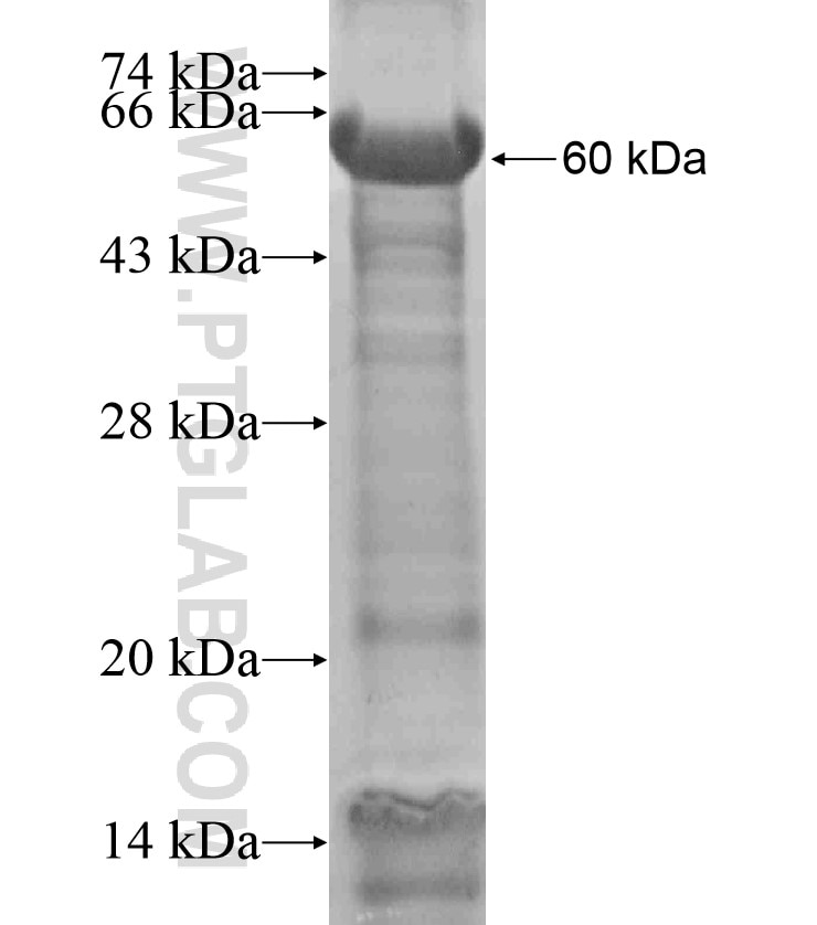 ZNF451 fusion protein Ag18346 SDS-PAGE