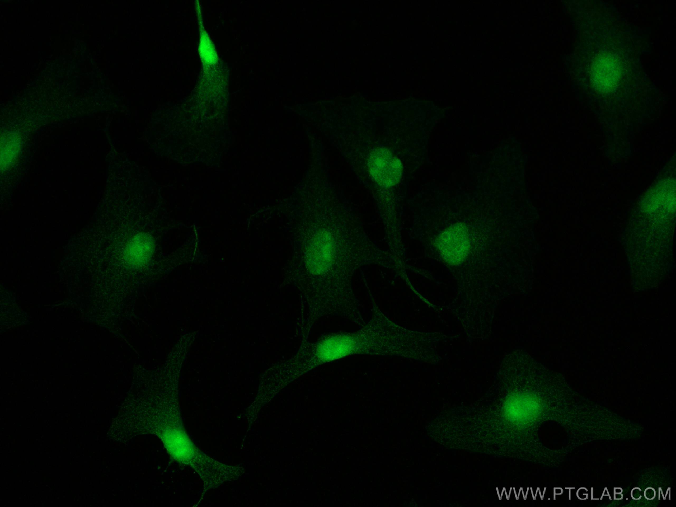 Immunofluorescence (IF) / fluorescent staining of HeLa cells using ZNF460 Polyclonal antibody (25299-1-AP)