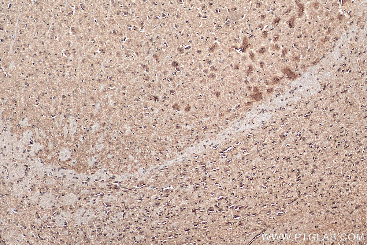 IHC staining of mouse brain using 25299-1-AP