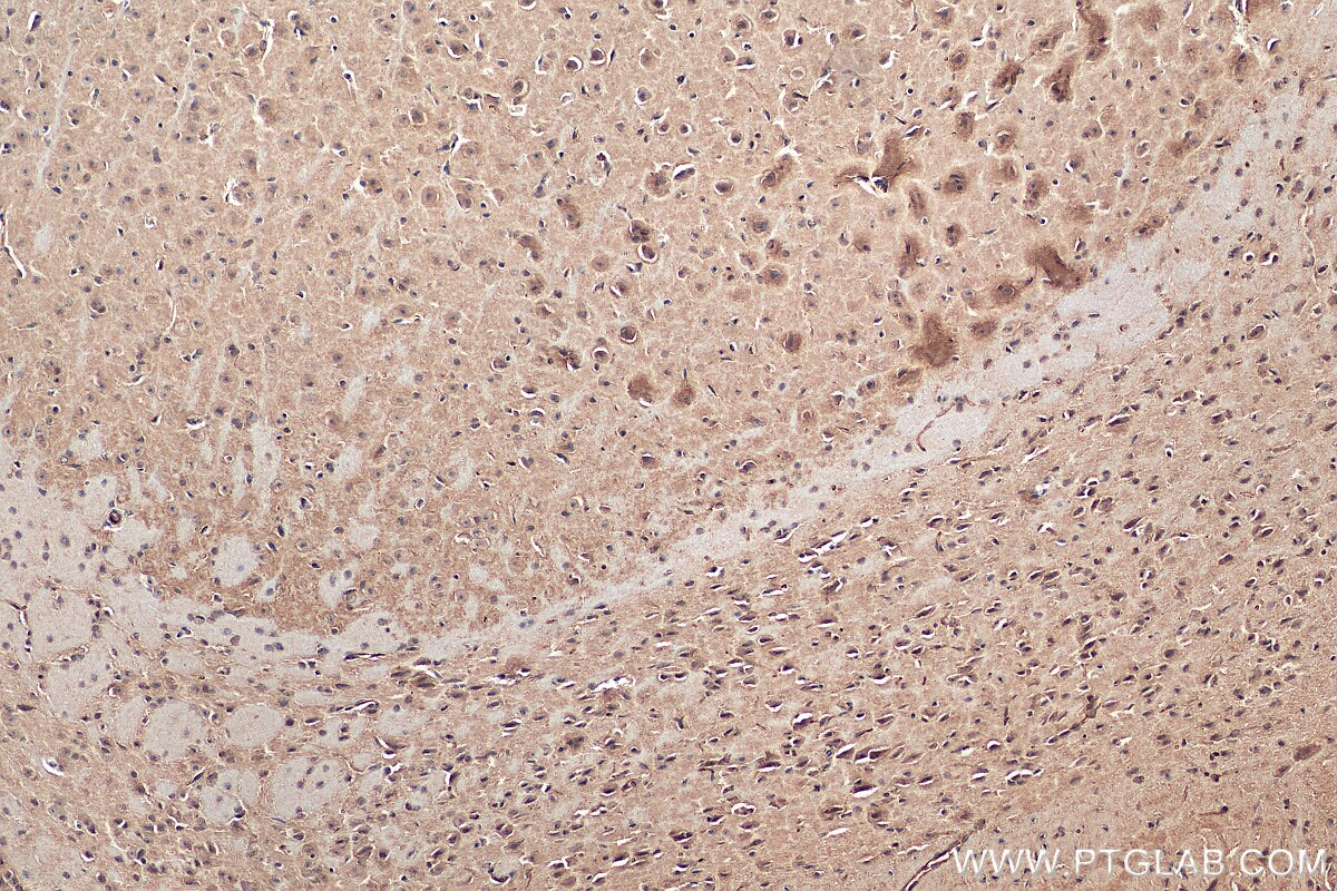 Immunohistochemistry (IHC) staining of mouse brain tissue using ZNF460 Polyclonal antibody (25299-1-AP)