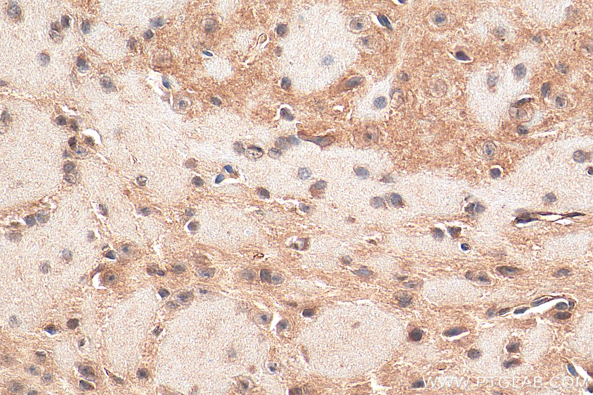 Immunohistochemistry (IHC) staining of mouse brain tissue using ZNF460 Polyclonal antibody (25299-1-AP)