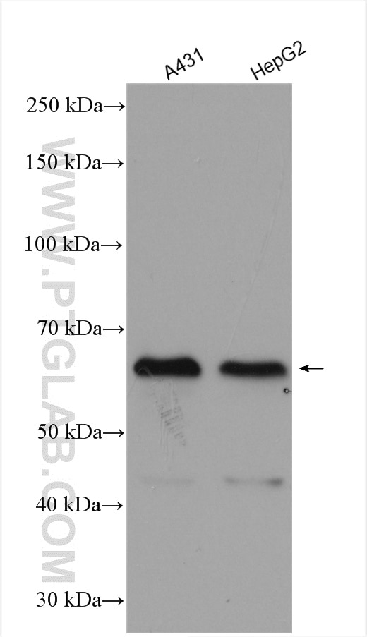 Western Blot (WB) analysis of various lysates using ZNF460 Polyclonal antibody (25299-1-AP)