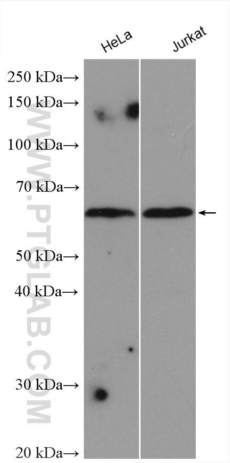 Western Blot (WB) analysis of various lysates using ZNF460 Polyclonal antibody (25299-1-AP)