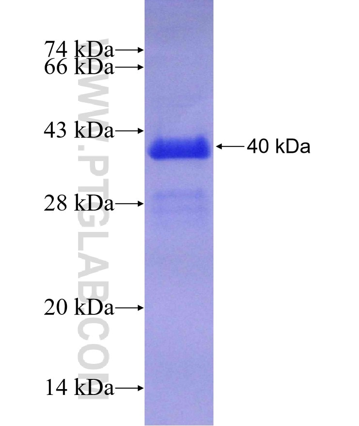 ZNF460 fusion protein Ag18106 SDS-PAGE