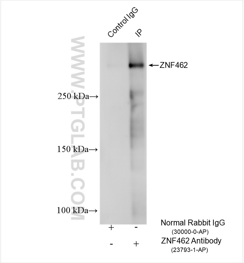 Immunoprecipitation (IP) experiment of mouse eye tissue using ZNF462 Polyclonal antibody (23793-1-AP)