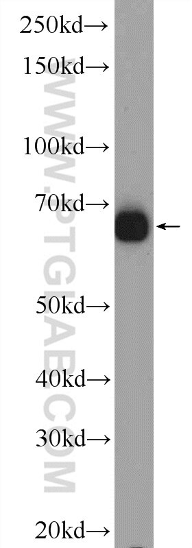 Western Blot (WB) analysis of Jurkat cells using ZNF48 Polyclonal antibody (25463-1-AP)