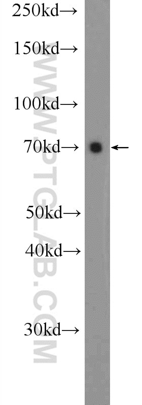 Western Blot (WB) analysis of PC-3 cells using ZNF48 Polyclonal antibody (25463-1-AP)