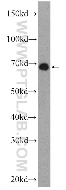 Western Blot (WB) analysis of HeLa cells using ZNF48 Polyclonal antibody (25463-1-AP)