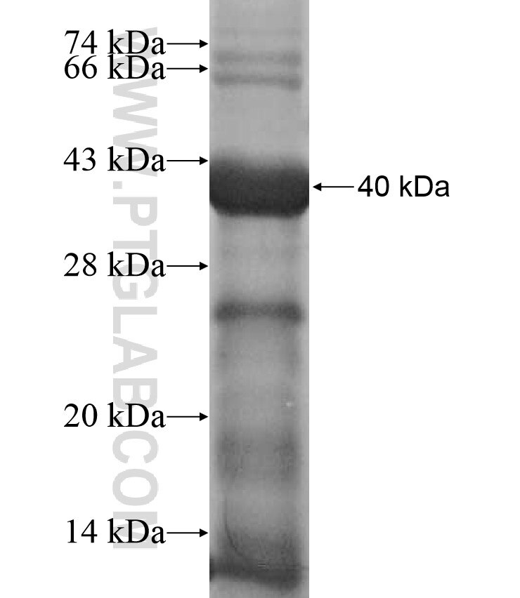 ZNF484 fusion protein Ag17349 SDS-PAGE