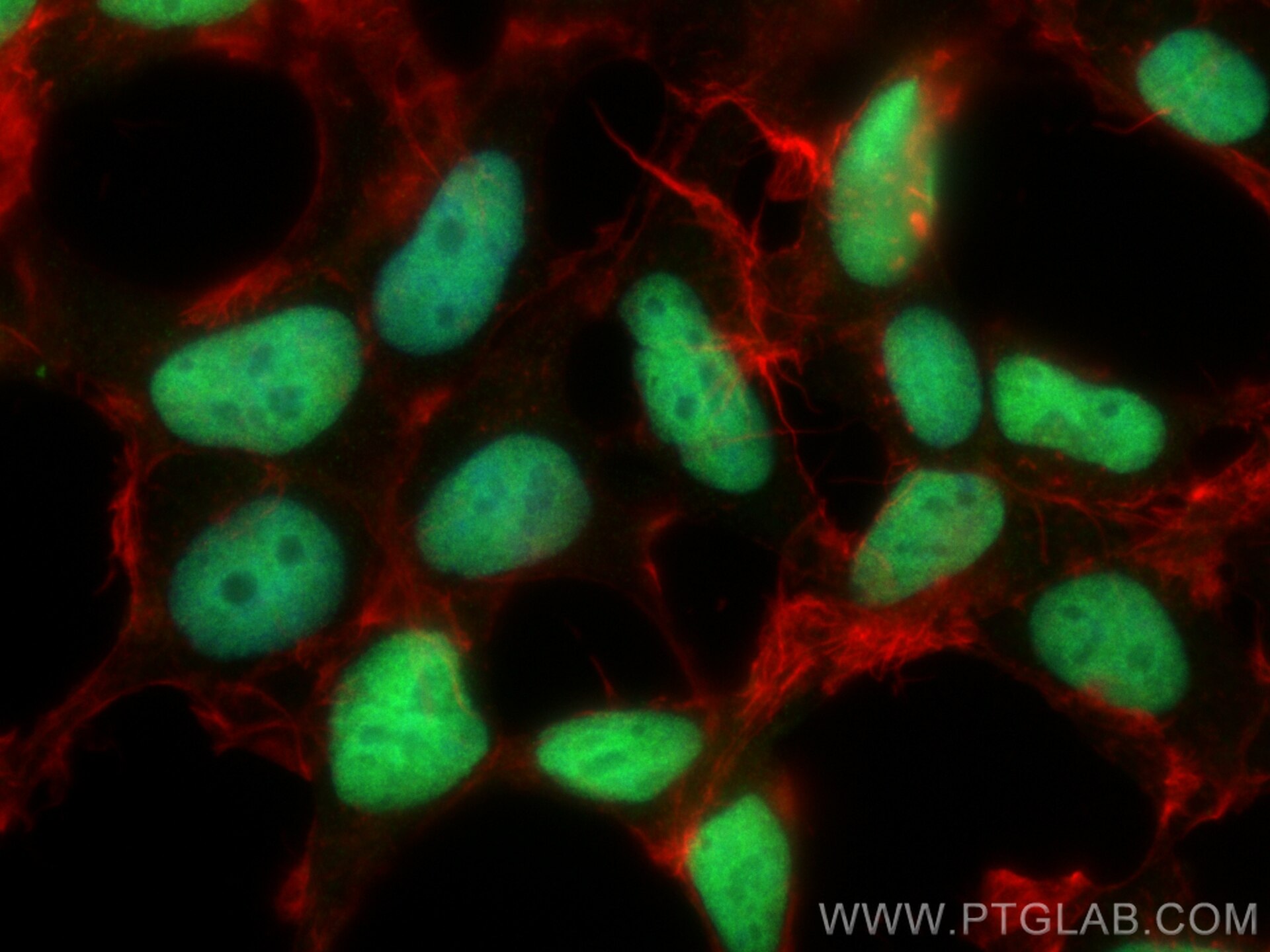 IF Staining of HEK-293 using 21083-1-AP Immunofluorescence (IF) / fluorescent staining of HEK-293 cells using ZNF485 Polyclonal antibody (21083-1-AP)