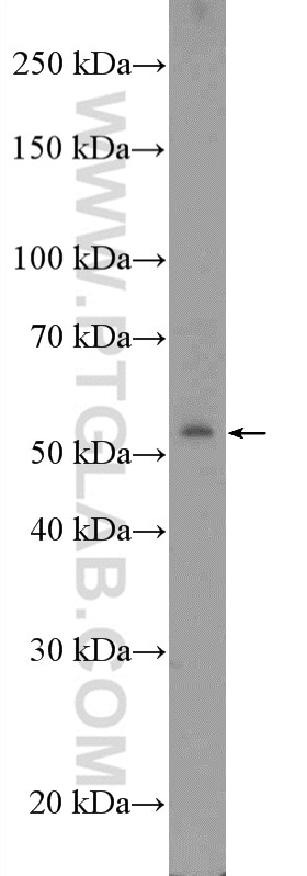 Western Blot (WB) analysis of COLO 320 cells using ZNF486 Polyclonal antibody (20599-1-AP)