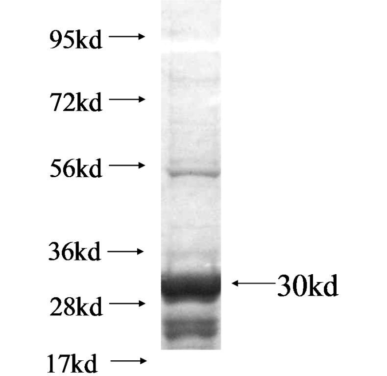 ZNF486 fusion protein Ag15065 SDS-PAGE