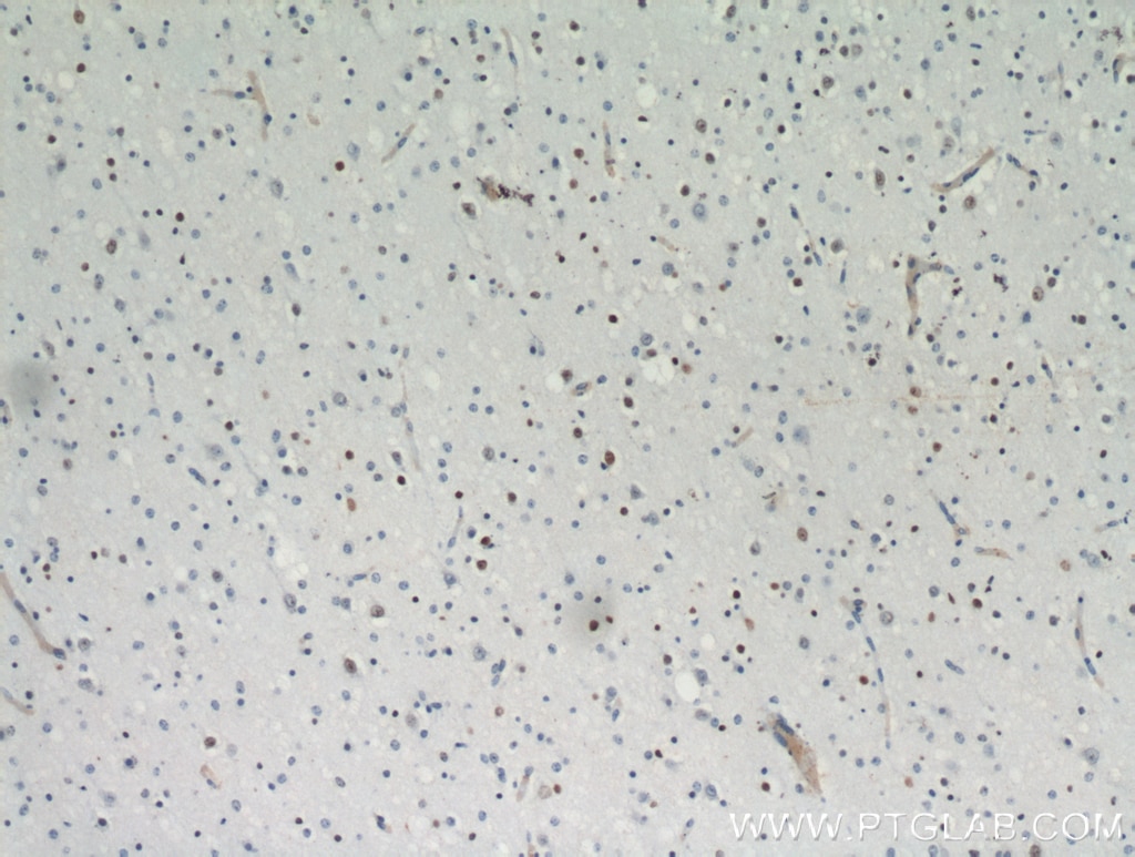 Immunohistochemistry (IHC) staining of human brain tissue using ZNF488 Polyclonal antibody (21014-1-AP)