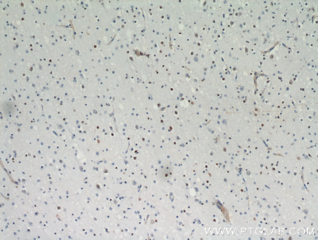 IHC staining of human brain using 21014-1-AP