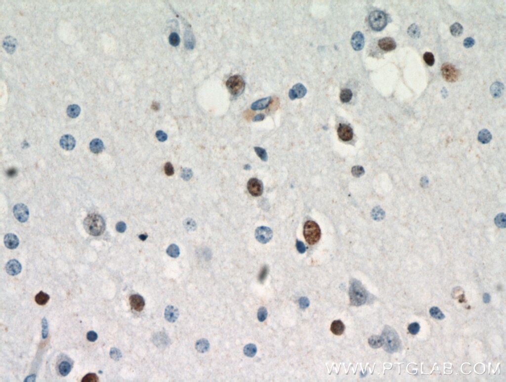 Immunohistochemistry (IHC) staining of human brain tissue using ZNF488 Polyclonal antibody (21014-1-AP)