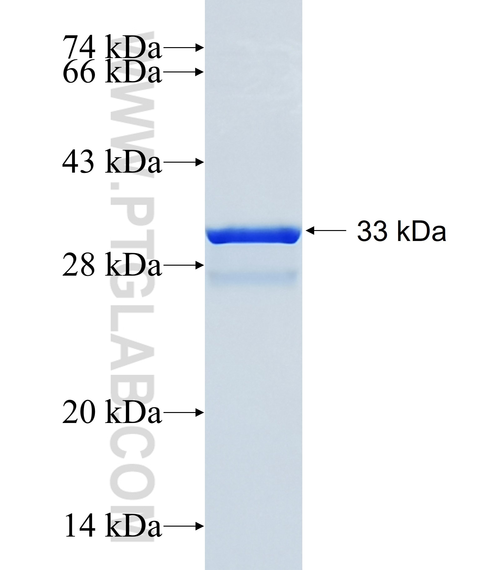 ZNF493 fusion protein Ag14577 SDS-PAGE