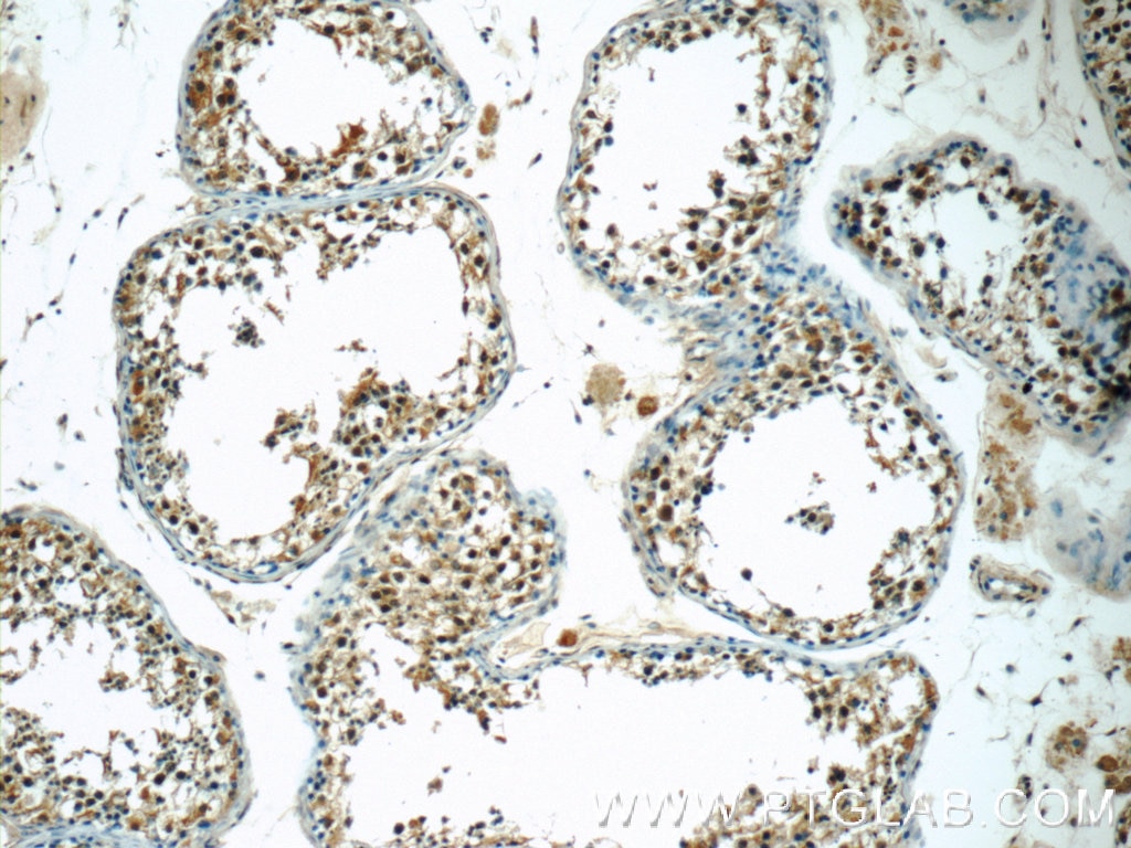 Immunohistochemistry (IHC) staining of human testis tissue using ZNF497 Polyclonal antibody (25178-1-AP)