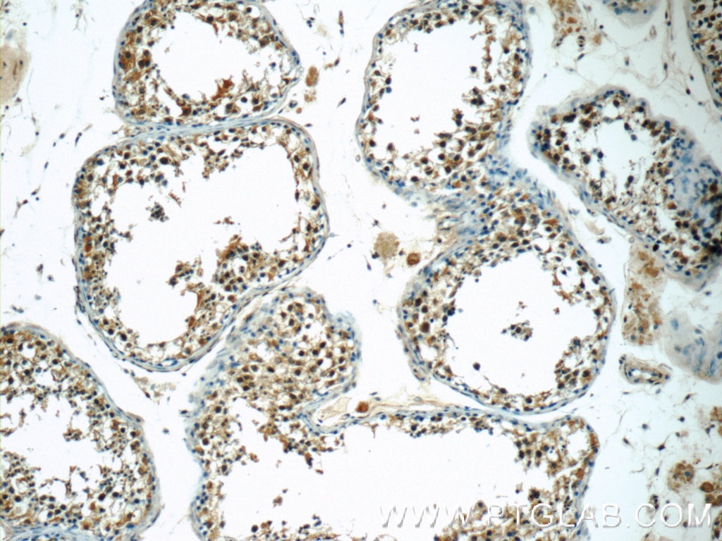 IHC staining of human testis using 25178-1-AP