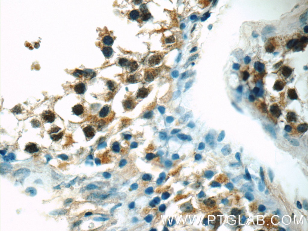 Immunohistochemistry (IHC) staining of human testis tissue using ZNF497 Polyclonal antibody (25178-1-AP)