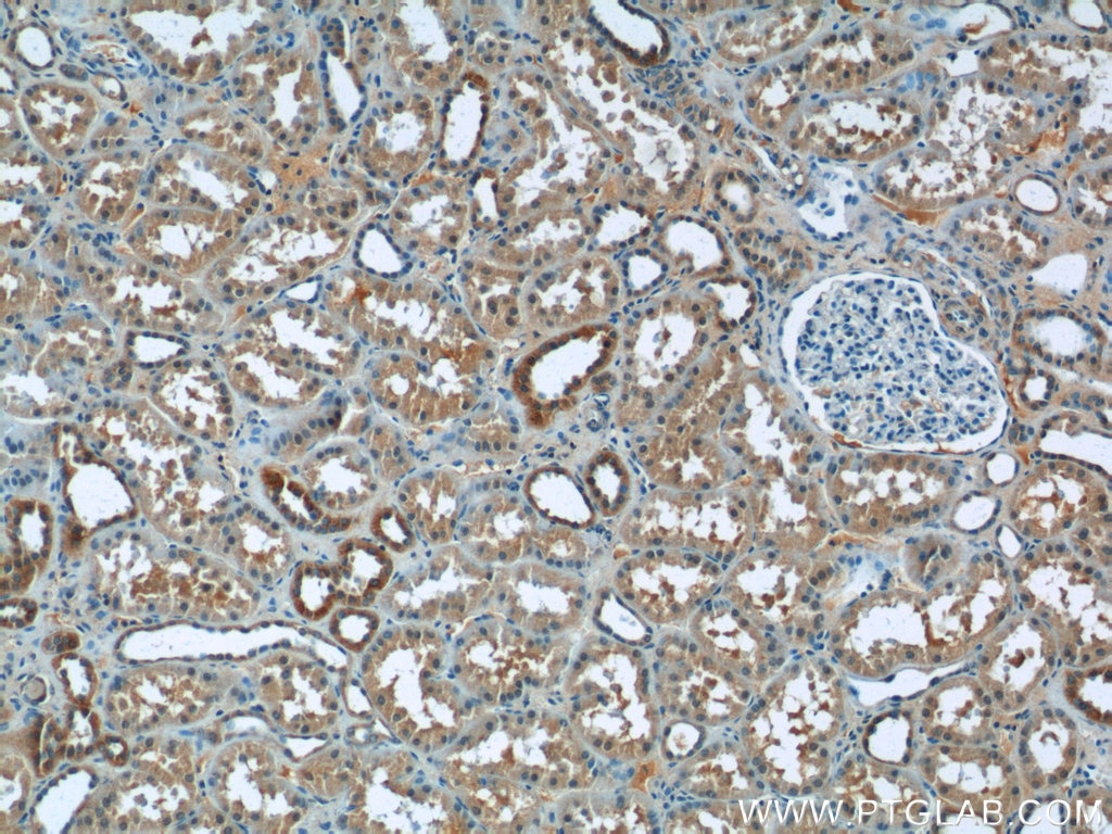 Immunohistochemistry (IHC) staining of human kidney tissue using ZNF497 Polyclonal antibody (25178-1-AP)