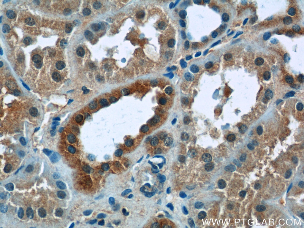 Immunohistochemistry (IHC) staining of human kidney tissue using ZNF497 Polyclonal antibody (25178-1-AP)