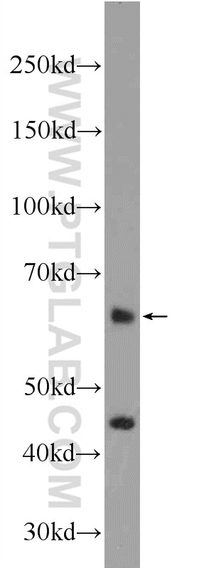 Western Blot (WB) analysis of mouse testis tissue using ZNF497 Polyclonal antibody (25178-1-AP)