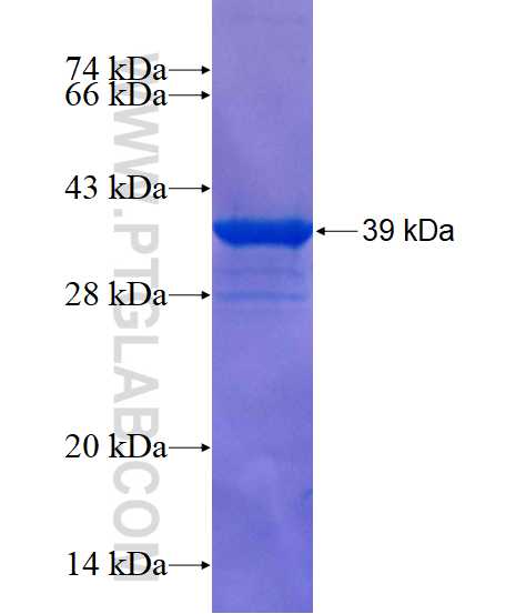 ZNF497 fusion protein Ag18114 SDS-PAGE