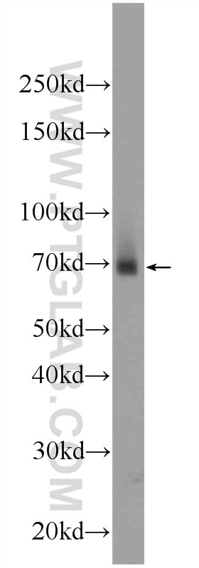 Western Blot (WB) analysis of mouse small intestine tissue using ZNF512 Polyclonal antibody (24508-1-AP)