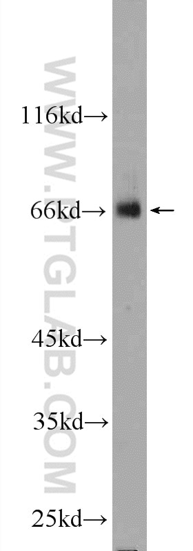 Western Blot (WB) analysis of PC-3 cells using ZNF512 Polyclonal antibody (24508-1-AP)