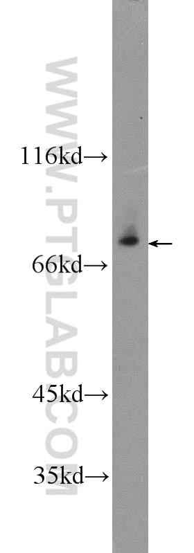 Western Blot (WB) analysis of A549 cells using ZNF512 Polyclonal antibody (24508-1-AP)