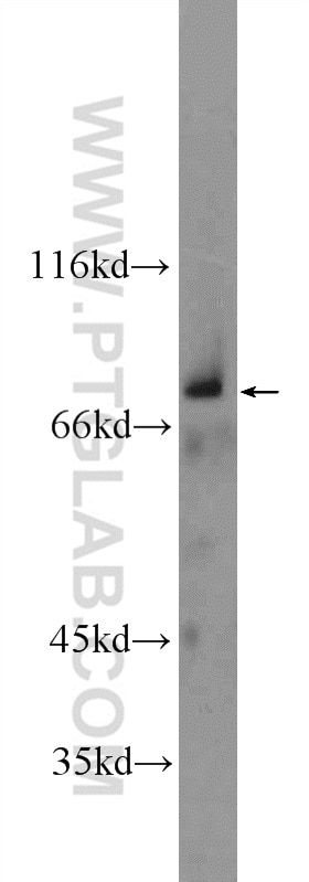 Western Blot (WB) analysis of fetal human brain tissue using ZNF512 Polyclonal antibody (24508-1-AP)