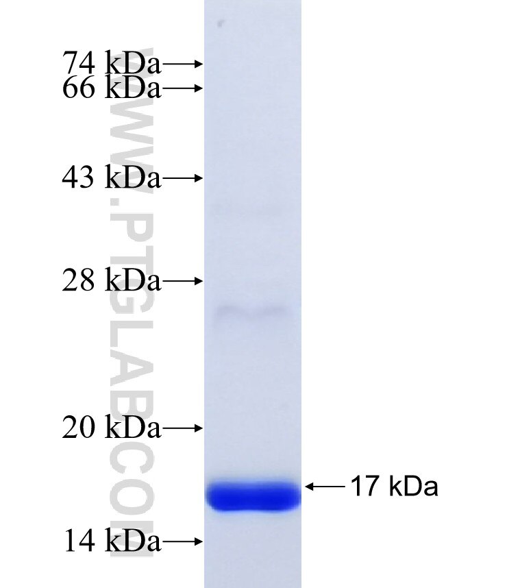 ZNF513 fusion protein Ag40605 SDS-PAGE ZNF513 fusion protein Ag40605 SDS-PAGE