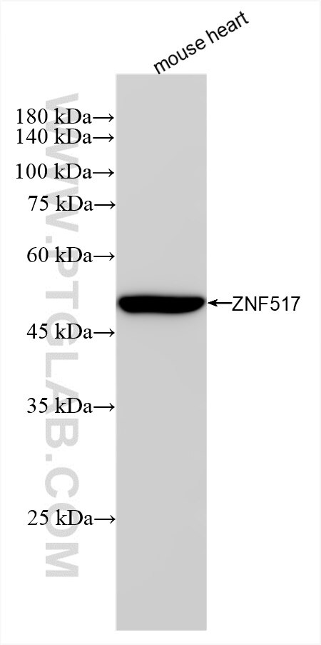 Western Blot (WB) analysis of various lysates using ZNF517 Recombinant antibody (85023-2-RR)